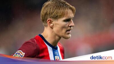 Martin Odegaard Cedera, Mikel Arteta Ungkap Kondisinya